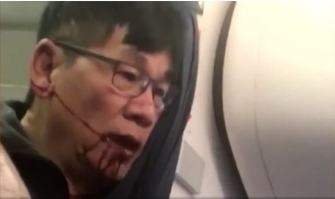 69-річний пасажир United з розбитим охоронцями обличчям Пасажира United Airlines витягли з літака, щоб посадити свого працівника