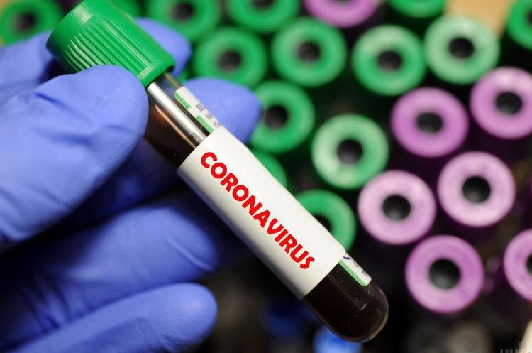 Зафіксовано 62 нові випадки COVID-19 за добу Зафіксовано 62 нові випадки COVID-19 за добу