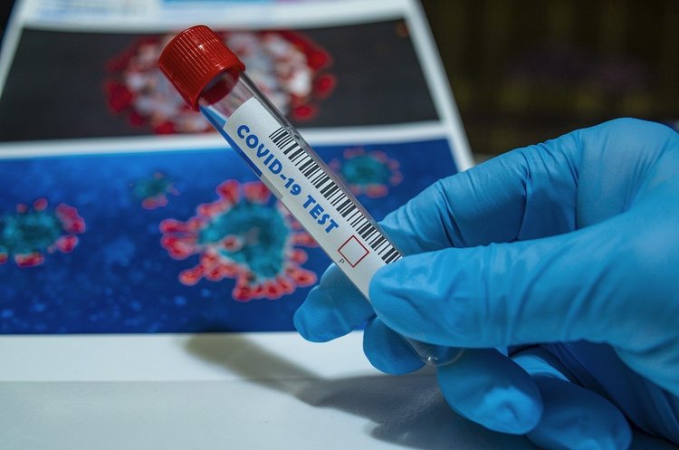 В Україні за добу зафіксовано 422 нових випадки інфікування коронавірусом В Україні за добу зафіксовано 422 нових випадки інфікування коронавірусом