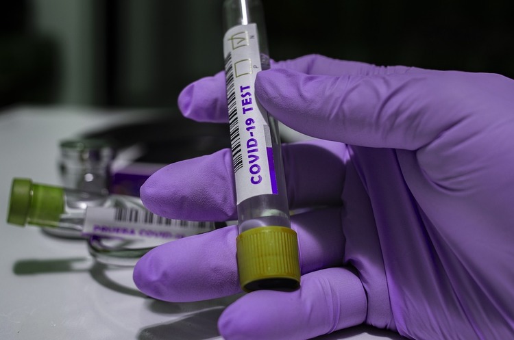 За добу в Україні зафіксовано 528 нових випадків COVID-19 За добу в Україні зафіксовано 528 нових випадків COVID-19