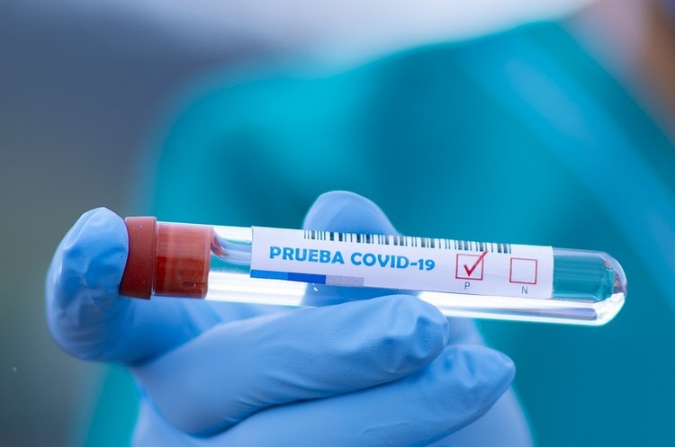 За добу в Україні діагностували понад 800 випадків COVID-19 За добу в Україні діагностували понад 800 випадків COVID-19