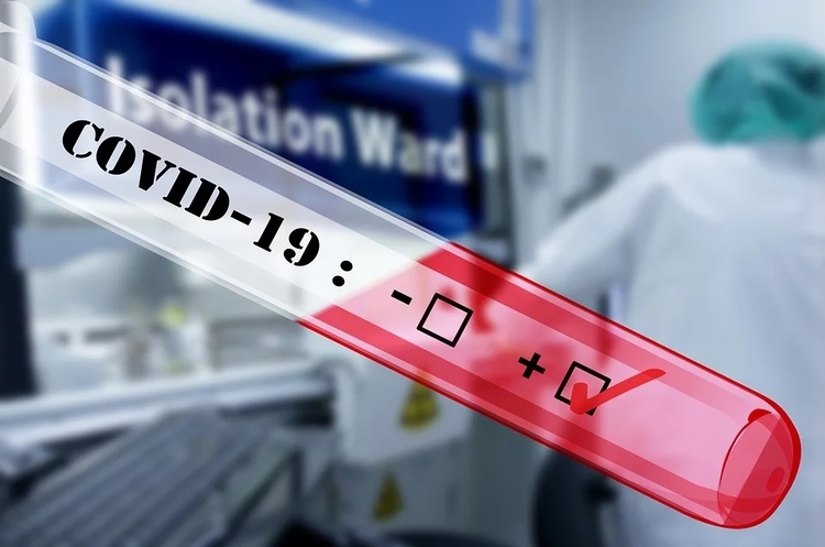 Украина обновила рекорд по количеству новых случаев COVID-19 за сутки Украина обновила рекорд по количеству новых случаев COVID-19 за сутки