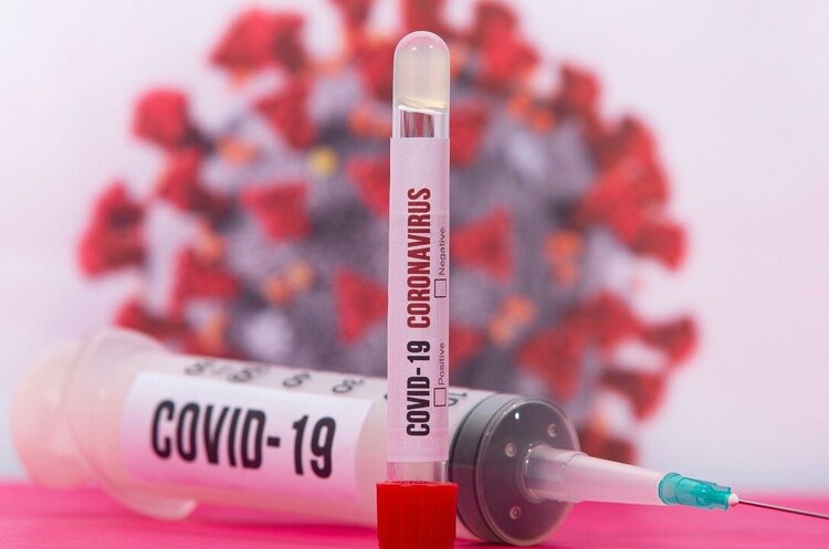 За сутки в Украине зафиксировали чуть более 1000 новых случаев COVID-19 За сутки в Украине зафиксировали чуть более 1000 новых случаев COVID-19