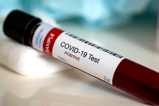 В Україні за добу 4 348 захворілих на COVID-19 В Україні за добу 4 348 захворілих на COVID-19