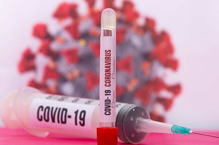 В Україні до добу виявили 5728 нових випадків COVID-19 В Україні до добу виявили 5728 нових випадків COVID-19