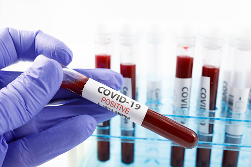 В Україні за добу 5 590 хворих на COVID-19 В Україні за добу 5 590 хворих на COVID-19