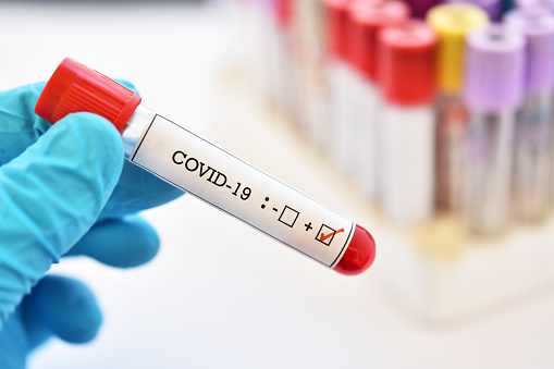 В Україні за добу 7 959 хворих на Covid-19 В Україні за добу 7 959 хворих на Covid-19