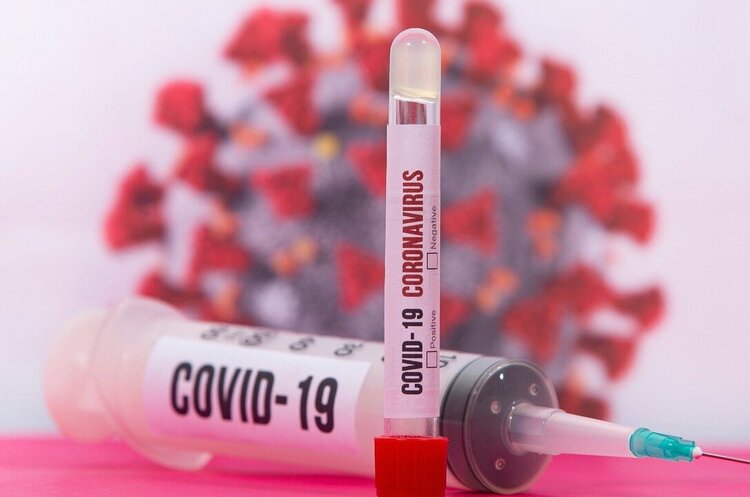 В Україні за добу зафіксували 11 787 нових випадків COVID-19 В Україні за добу зафіксували 11 787 нових випадків COVID-19