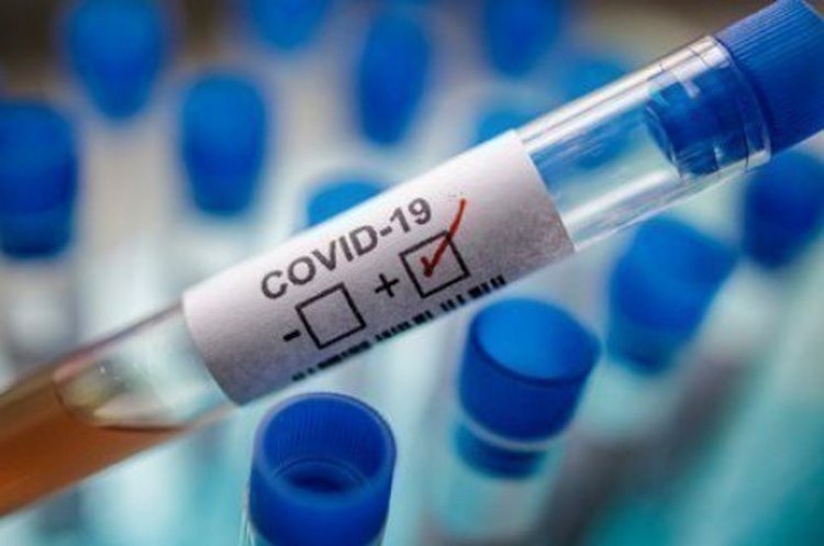 фото DR В США дозволили застосовувати в домашніх умовах перший тест на коронавірус