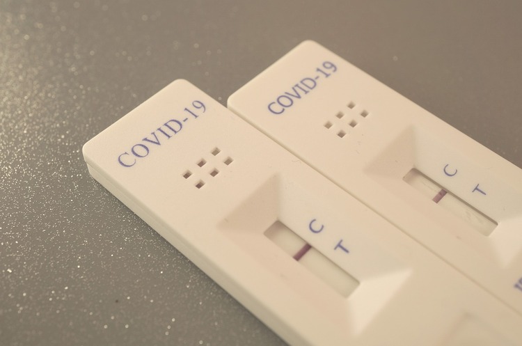 За добу в Україні виявили 4310 нових випадків COVID-19 За добу в Україні виявили 4310 нових випадків COVID-19