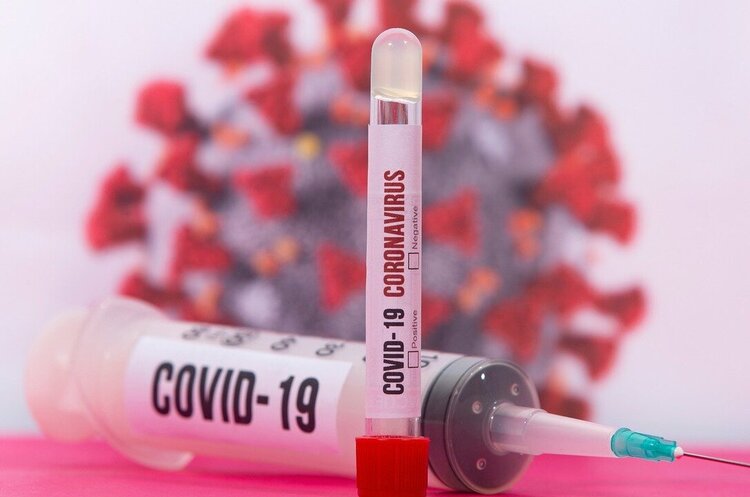 За добу в Україні зафіксували 8172 нових випадків COVID-19 За добу в Україні зафіксували 8172 нових випадків COVID-19