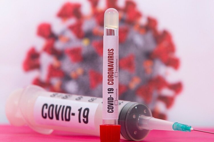 За добу в Україні зафіксували 5572 нових випадки COVID-19 За добу в Україні зафіксували 5572 нових випадки COVID-19
