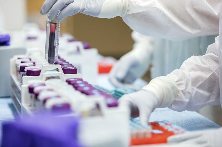 Німецька CureVac розраховує на схвалення своєї вакцини в ЄС в II кварталі Німецька CureVac розраховує на схвалення своєї вакцини в ЄС в II кварталі