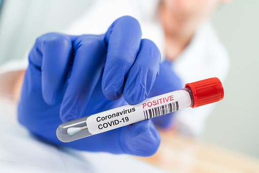 В Україні за добу зафіксовано 14 553 нові випадки інфікування COVID-19 В Україні за добу зафіксовано 14 553 нові випадки інфікування COVID-19