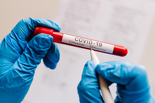 В Україні за добу зафіксовано 17 479 нових випадків інфікування COVID-19 В Україні за добу зафіксовано 17 479 нових випадків інфікування COVID-19