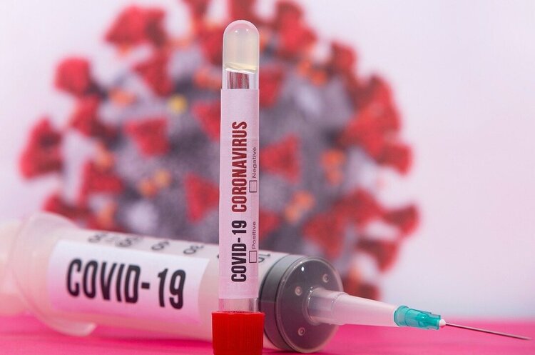 За добу в Україні зафіксували 6038 нових випадків COVID-19 За добу в Україні зафіксували 6038 нових випадків COVID-19