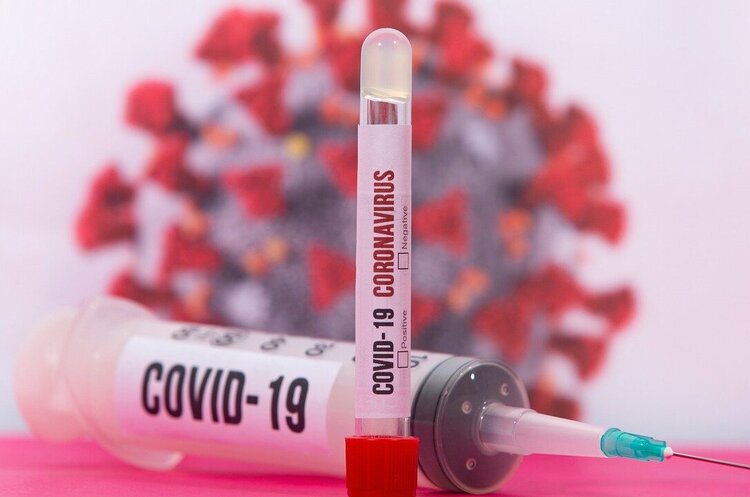 В Україні за добу зафіксували 6813 нових випадків COVID-19 В Україні за добу зафіксували 6813 нових випадків COVID-19