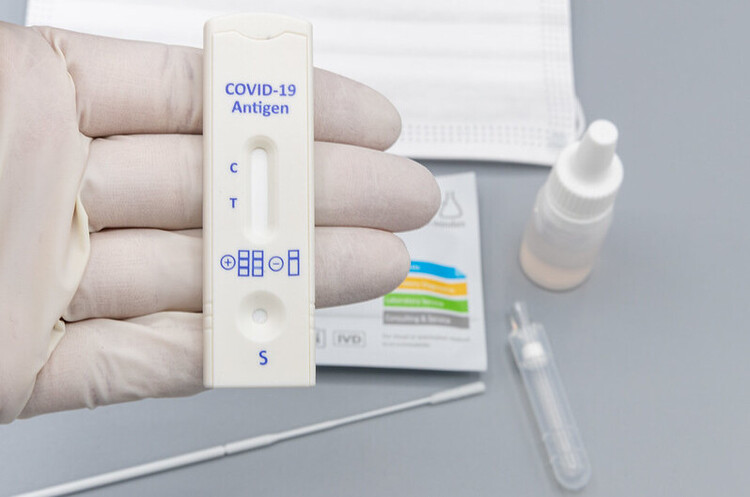 В Україні за добу зафіксували 2137 нових випадків COVID-19 В Україні за добу зафіксували 2137 нових випадків COVID-19