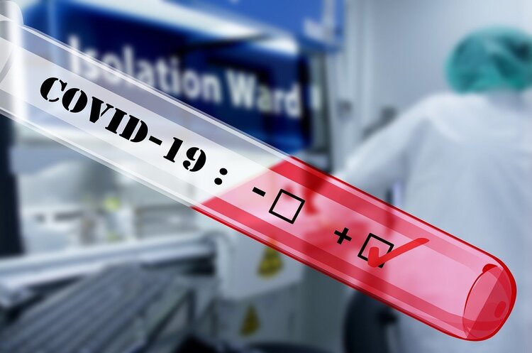 В Україні за добу зафіксували 696 нових випадків COVID-19 В Україні за добу зафіксували 696 нових випадків COVID-19