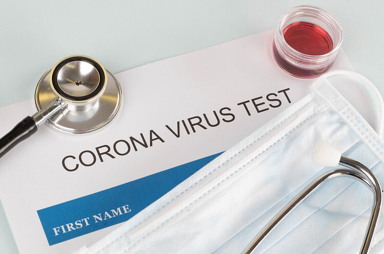 В Україні за добу зафіксували 846 нових випадків COVID-19 В Україні за добу зафіксували 846 нових випадків COVID-19