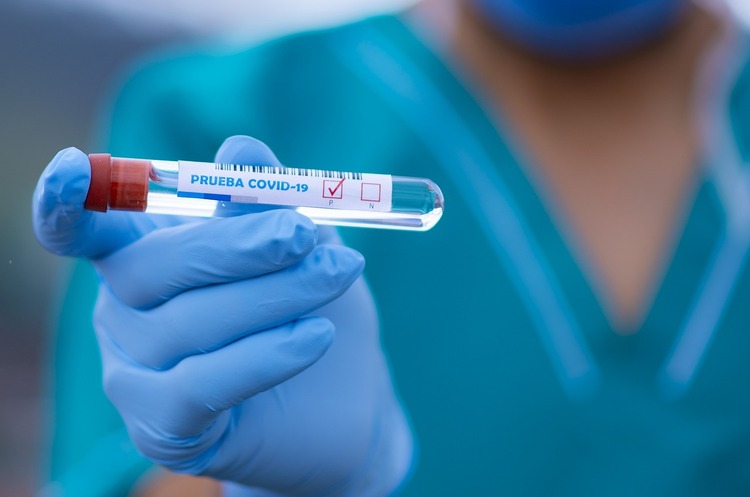 В Україні за добу зафіксували 2614 нових випадків COVID-19 В Україні за добу зафіксували 2614 нових випадків COVID-19