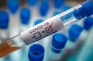 В ПАР через появу більш заразного омікрон-штаму різко зросла кількість хворих на COVID