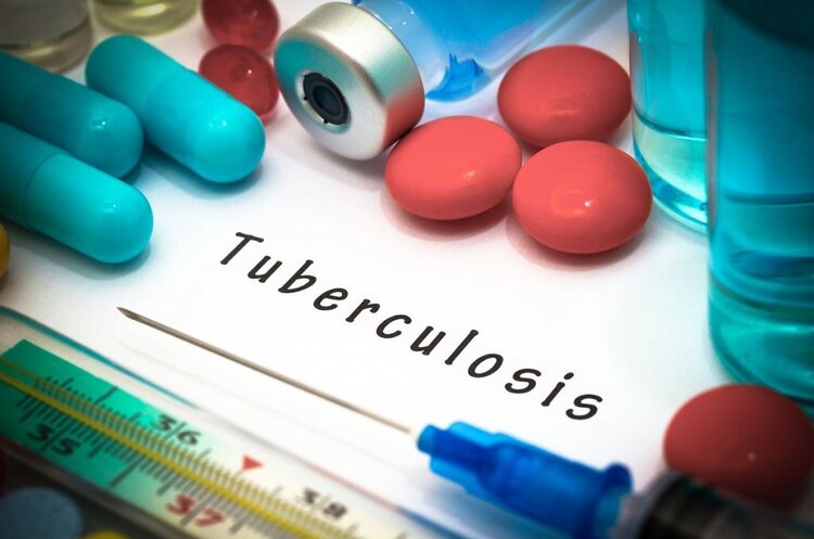 The Verkhovna Rada has passed a law to tackle tuberculosis in Ukraine The Verkhovna Rada has passed a law to tackle tuberculosis in Ukraine