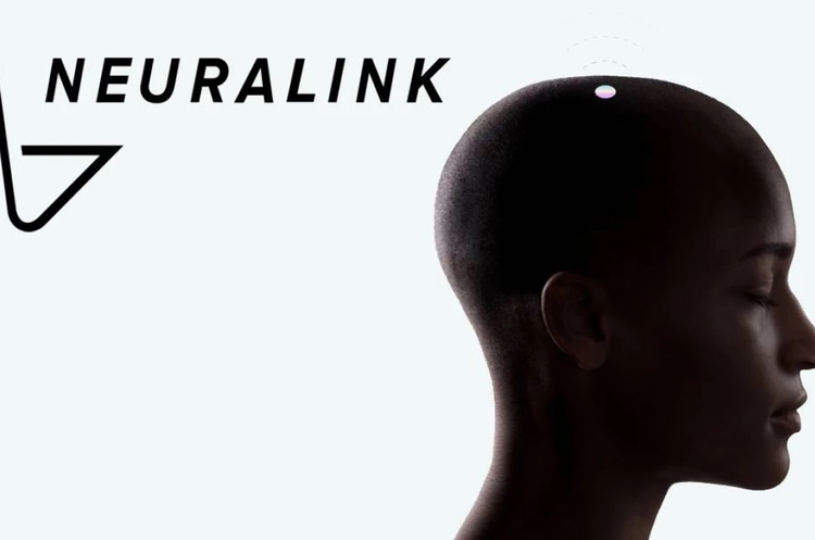Перша людина вживила у свій мозок імплант від компанії Ілона Маска Neuralink Перша людина вживила у свій мозок імплант від компанії Ілона Маска Neuralink